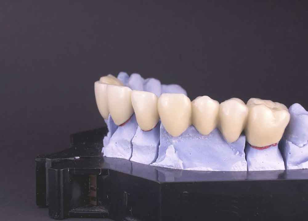 Dental Care